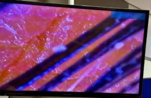 炎症を起こしている頭皮